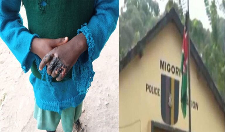 Shock as mother burns her THREE children's hands over Ksh 20