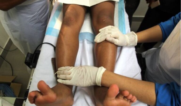 Ten-year-old boy hospitalised after circumcising himself using a kitchen knife