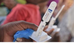 Government responds over reports of substandard HIV testing kits in the country