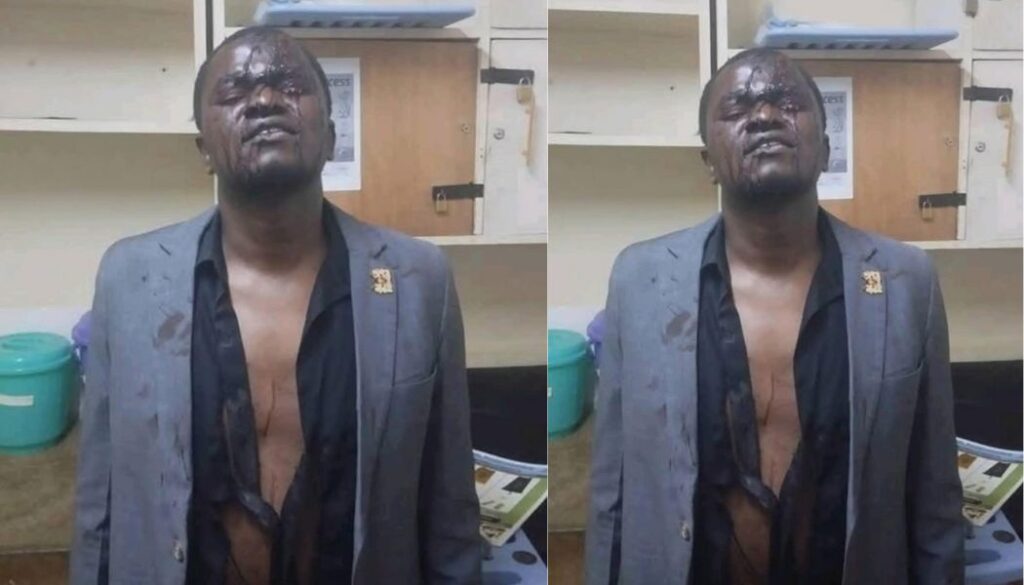 Cleophas Malala's driver injured after allegedly being assaulted by Police