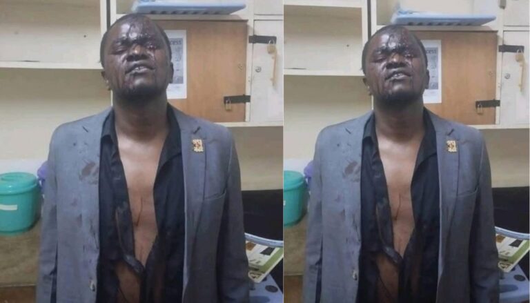 Cleophas Malala's driver injured after allegedly being assaulted by Police