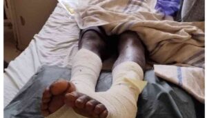 Independent Policing Oversight Authority (IPOA) has launched investigations into the alleged assault of a 17-year-old boy while in police custody
