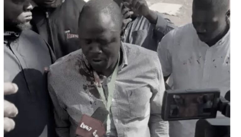 Tension erupted at the Agoro Sare polling centre in Kasipul on Thursday, November 27, after Homa Bay Town MP Peter Kaluma was attacked