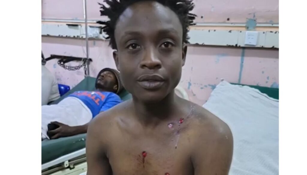 Boda boda operator Daniel Gichimu sustained injuries after he was shot seven times in Ruiru by men believed to be police officers during the fuel protests.