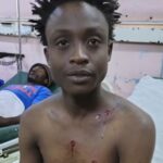 Boda boda operator Daniel Gichimu sustained injuries after he was shot seven times in Ruiru by men believed to be police officers during the fuel protests.