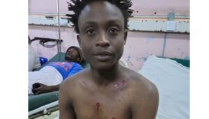 Boda boda operator Daniel Gichimu sustained injuries after he was shot seven times in Ruiru by men believed to be police officers during the fuel protests.