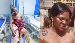 Police break silence after woman with Ruto’s tattoo is doused in petrol