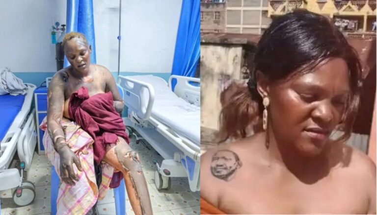 Police break silence after woman with Ruto’s tattoo is doused in petrol