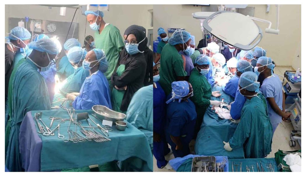 KNH doctors remove 4kg liver tumour in 7-hour complex surgery